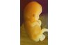 Actual fetus at seven weeks gestational age.