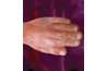 Actual hand of a developing fetus at twelve weeks.