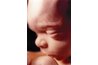 Actual fetus at twenty weeks of gestation.