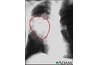 Image courtesy of National Institute of Health