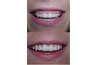 Tissue grafting and contouring can also resolve "gummy" smile issues.