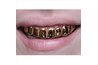 Gold dental crowns are going to be very obvious in the front of your mouth.