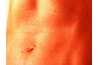Close examination of toned belly reveals creases caused by excess skin