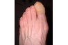 Bandaid on toe