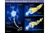 Multiple Sclerosis _ HowStuffWorks.com