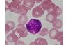 Basophil, Dept. of Histology, Jagiellonian UMC, GFDL, http://histologia.cm-uj.krakow.pl/index.html