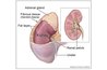 In a radical nephrectomy, the kidney, ureter and adrenal gland are removed.