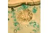 Scabies Mite