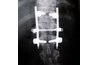 Spinal Fusion X-Ray