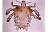 Pubic Louse (Pubic Domain, Wiki Commons)