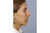 Before: http://amazingfaces.com/gallery.php?ID=33&&