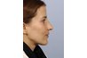 After: http://amazingfaces.com/gallery.php?ID=33&&