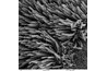 Scanning electron microscope image of cilia in lungs (public domain)
