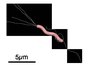 H pylori