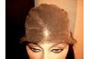 To repair teirs use small stiches!!! It should be undetectable, No lumps or bumps!