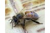 A bee sting can cause a severe allergic reaction: anaphylaxis.