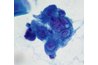 HSV-2 infected cells