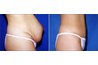 PlasticSurgery1.com