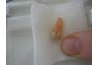 Extracted tooth