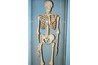 Strenghtening bones is just one of calcium's functions.
