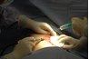By the 1900s, surgical gloves were routinely worn during operations.