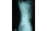 Spine X-Ray