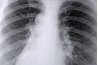 It could cause breathing problems if inhaled.