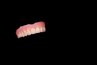 Soaking dentures overnight allows vinegar to clean and whiten them.
