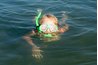 Swimmer's itch most commonly affects swimmers and snorkelers