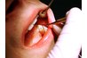 If tooth pain persists, see a dentist.
