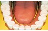 The American Dental Hygienists Association estimate that 75% of Americans suffer from some form of periodontal disease.