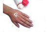 Most treatments for dermatitis involve creams, whether prescription or over-the-counter