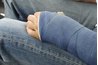 Young man sits with his arm in a soft cast