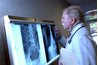 Spinal x-ray