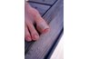 Injured toe