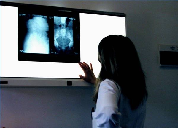 What Can Cause Severe Colon Pain? What Can Cause Severe Colon Pain?