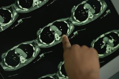 mri