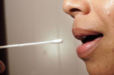Swabbing of the inside of cheek to collect DNA sample.
