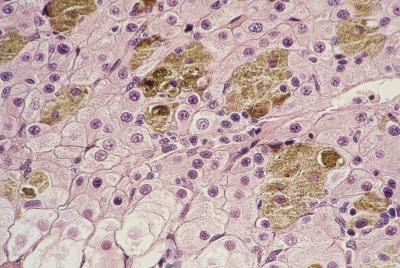 Magnified liver tissue.