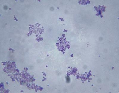 Weather conditions and viral pathogens can cause lesions in spinach leaves.