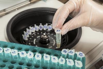 DNA extraction is also used to match genetic material at a crime scene.