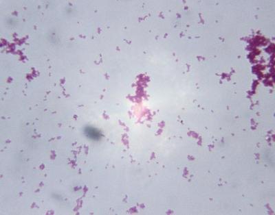 Microscopic image of gonorrhea