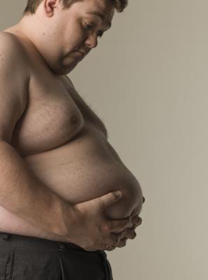 Obese individuals face unique challenges in group fitness programs. Obese individuals face unique challenges in group fitness programs.