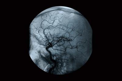 Scan of vascular structure.