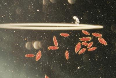 Anaerobic respiration is performed by many single celled organisms.
