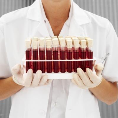 There are two types of blood tests.