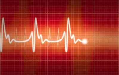 EKG.