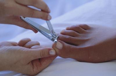 Nail fungus can be spread through the use of a shared toenail clipper.