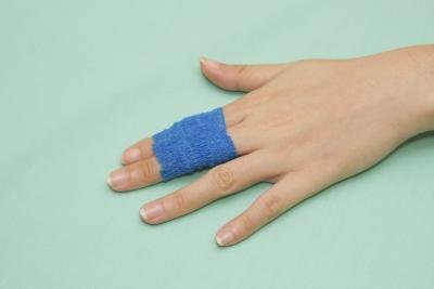A broken finger may be crooked.