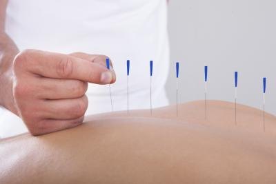 Acupuncture is an alternative treatment.